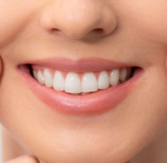 Tratamiento estética dental Innovación Dental Manzanares